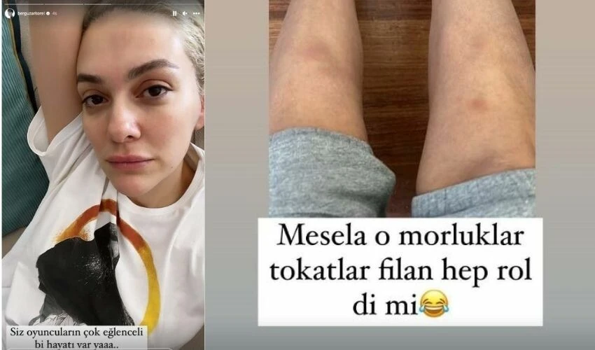 7 yıl sonra setlere dönen Bergüzar Korel isyan etti: Bu acıya yürek dayanmaz!