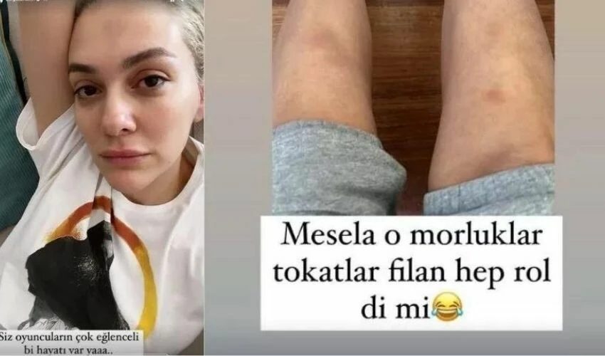 Set yoğunluğundan şikayet etmişti! Sergen Deveci çektiği videoyla Bergüzar Korel’i tiye aldı