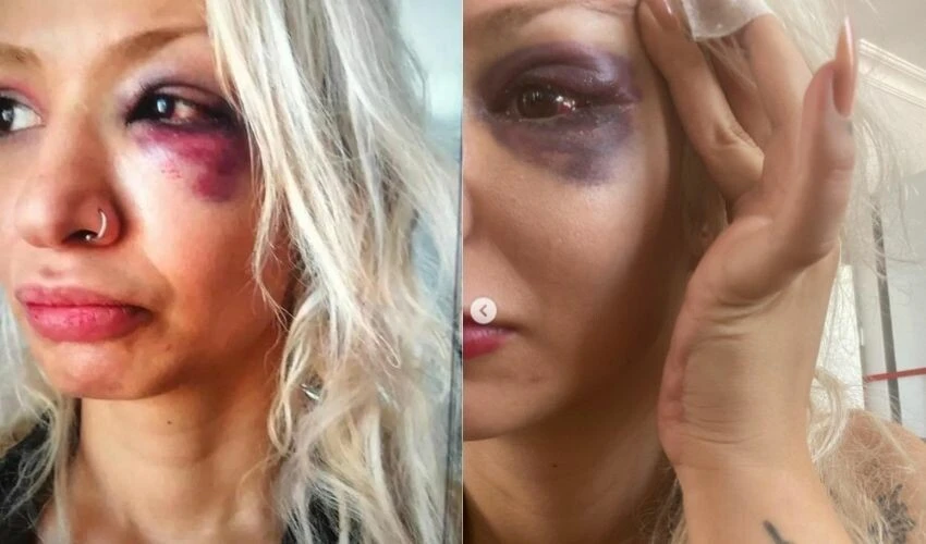 Yüzyüzeyken Konuşuruz'un gitaristi Can Tunaboylu'nun sevgilisini darp ettiği iddiası ortalığı karıştırdı