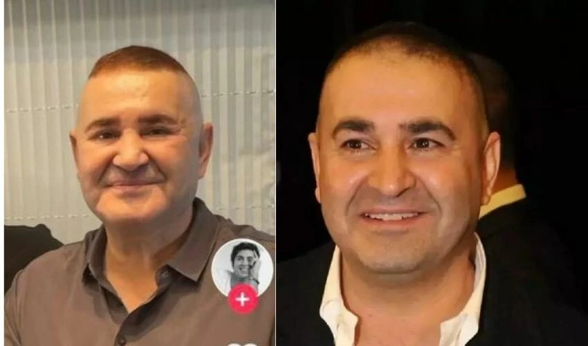 Şafak Sezer, estetiğin dozunu kaçırdı, takipçileri tanımakta güçlük çekti