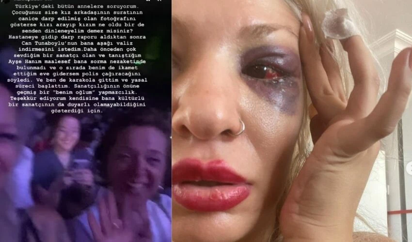 Şiddete uğradığını iddia eden Aybike Çelik, 'Oğlum yapmaz' diyen Ayşe Tunaboylu’ya seslendi