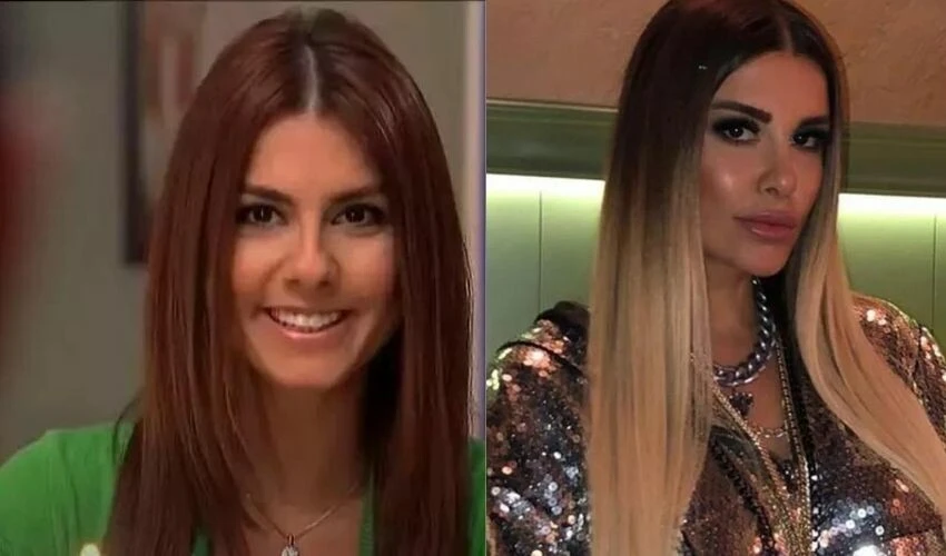 Adanalı’nın Pınar’ı Tuğçe Özbudak’tan estetik itirafı: Kariyer planı gibi