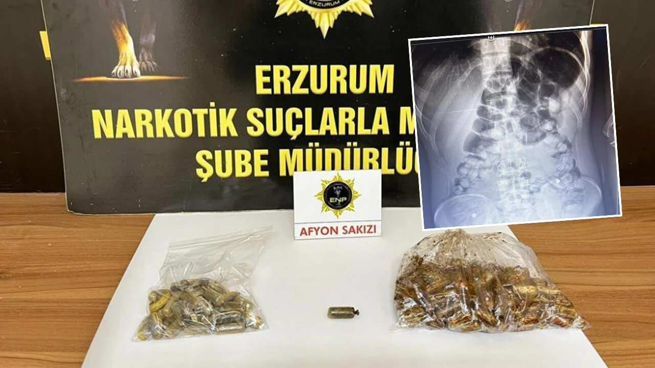 Yolcu otobüsünde şüpheli şahsın karnından 1 kilo 134 gram afyon sakızı çıktı