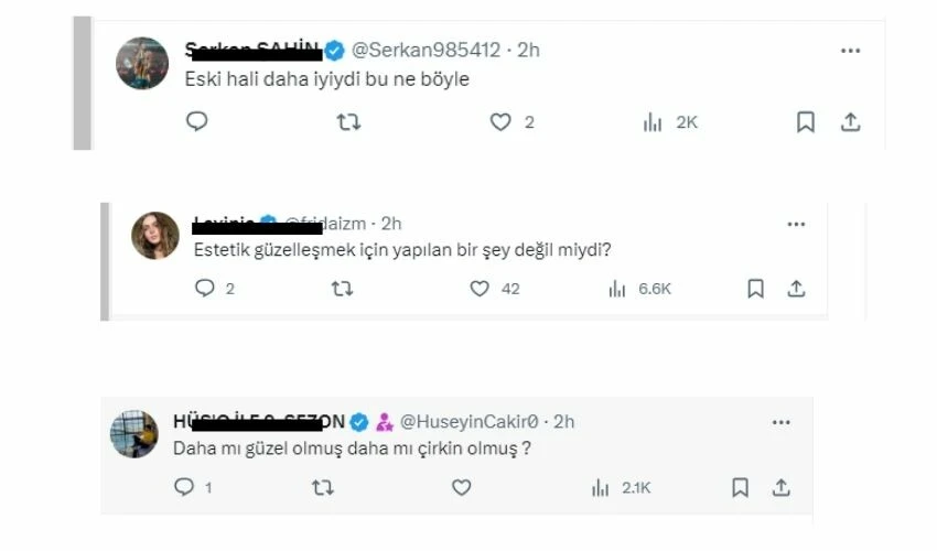 Estetiği abartan Adriana Lima’nın gözleri kayboldu