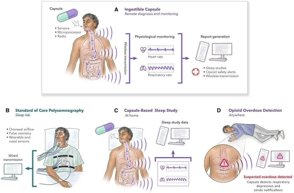 Bilim adamları bunu da yaptı: Yutulabilen akıllı kapsül bilinmeyen hastalıkları tespit edecek