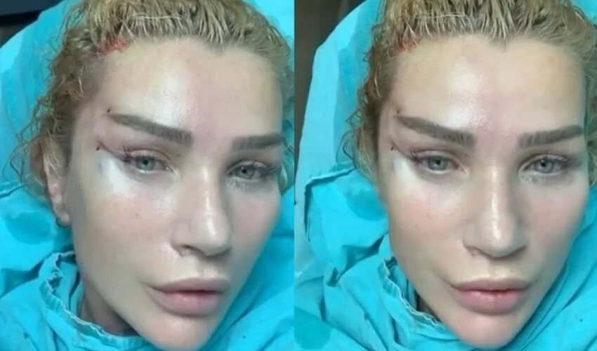 Seda Sayan harekete geçti! Ablasını da estetik doktoruna götürdü