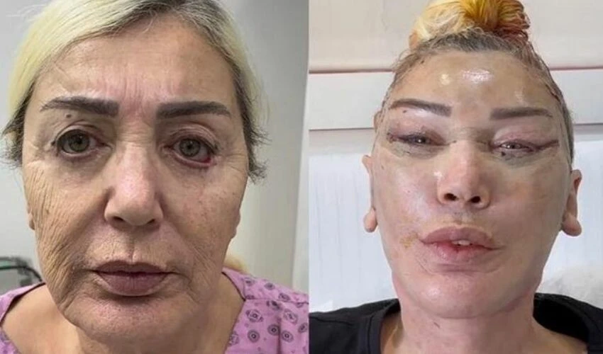 Seda Sayan harekete geçti! Ablasını da estetik doktoruna götürdü