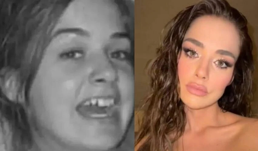 Bensu Soral 'Estetiğim yok' dedi, takipçileri eski fotoğrafları paylaştı