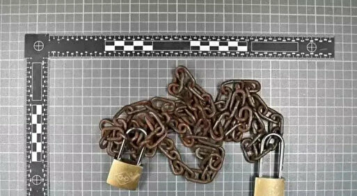 Boynundaki ve ellerindeki zincirlerle hastaneye daldı! Dehşeti yaşayan kadın her şeyi bir bir anlattı