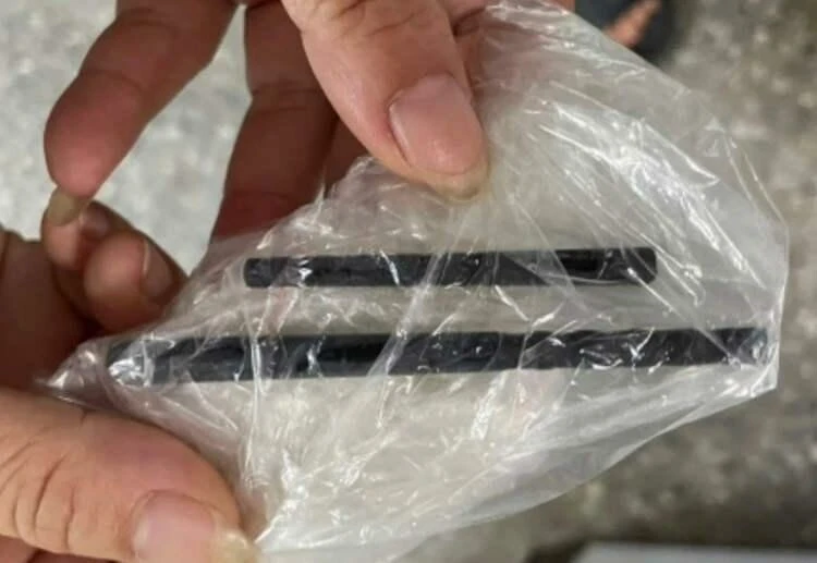 Şiddetli baş ağrısının sebebi kafasındaki yemek çubukları çıktı! 'Nasıl girdi ki?' sorusunun gizemi çözüldü