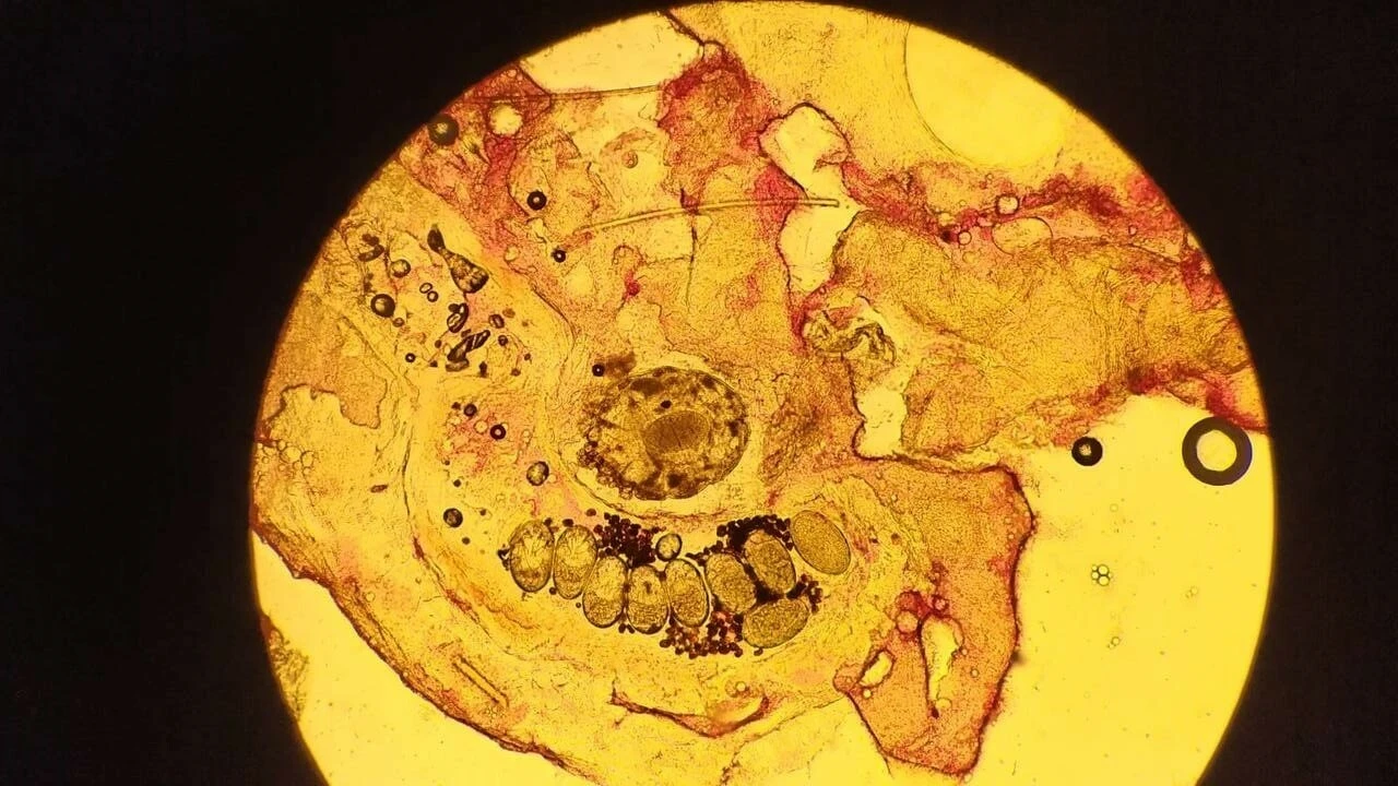 Uzmanlardan 'uyuz' uyarısı: Hafife almayın