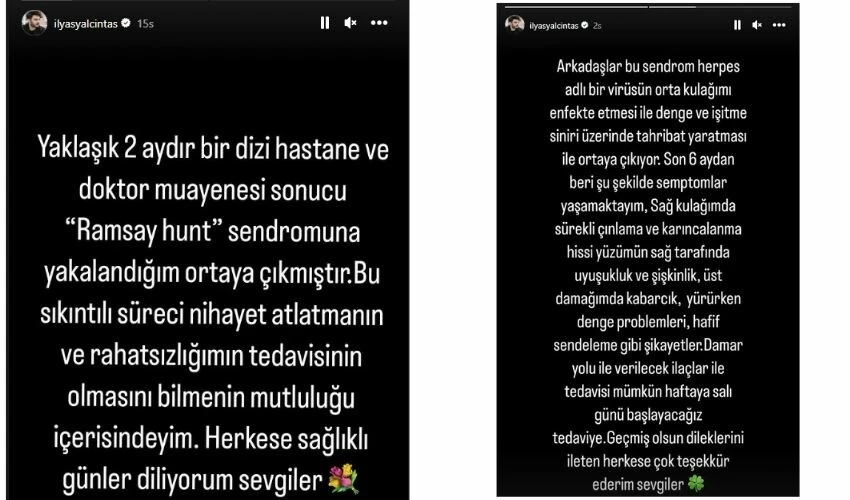 İlyas Yalçıntaş Ramsay Hunt sendromuna yakalandı