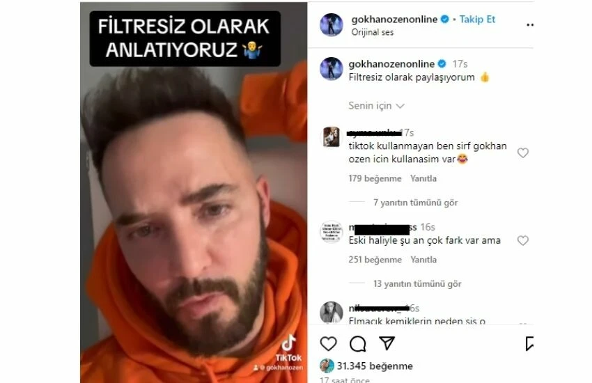 Gökhan Özen estetik yaptırdığı iddialarını kabul etmedi: İftiralarla uğraşıyorum