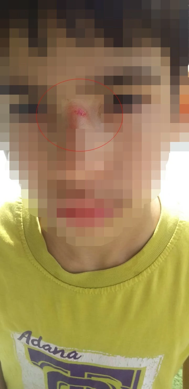 Akran zorbalığı 3. sınıfa kadar düştü! Okuldan her geldiğinde aynı