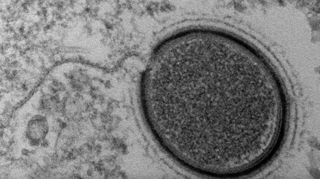 Küresel ısınma, 50 bin yıllık 'ölümü' ortaya çıkardı: Dünya yeni bir salgın tehlikesiyle karşı karşıya