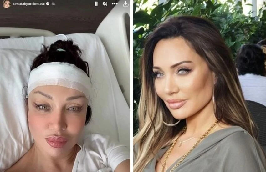 Sanatçı Umut Akyürek'e alın daraltma ameliyatı sonrası eleştiri yağdı