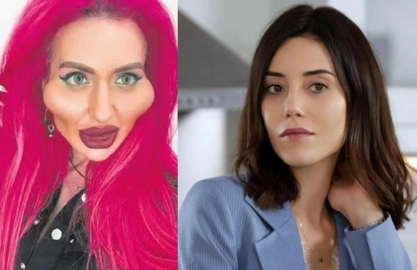 Cansu Dere, estetik hakkında konuştu: İnsan gibi görünmenin dışına çıktılar - 1. Resim