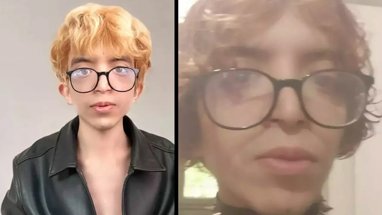 'Tablet Reis' acılarla dolu hayat hikayesi... 35 kiloya kadar düştü, çalışamıyor