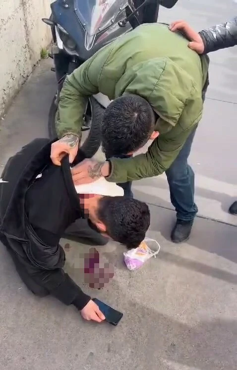 Çağlayan'daki saldırıda ağır yaralının yardımına çevredekiler koşmuştu: Kurtarılamadı