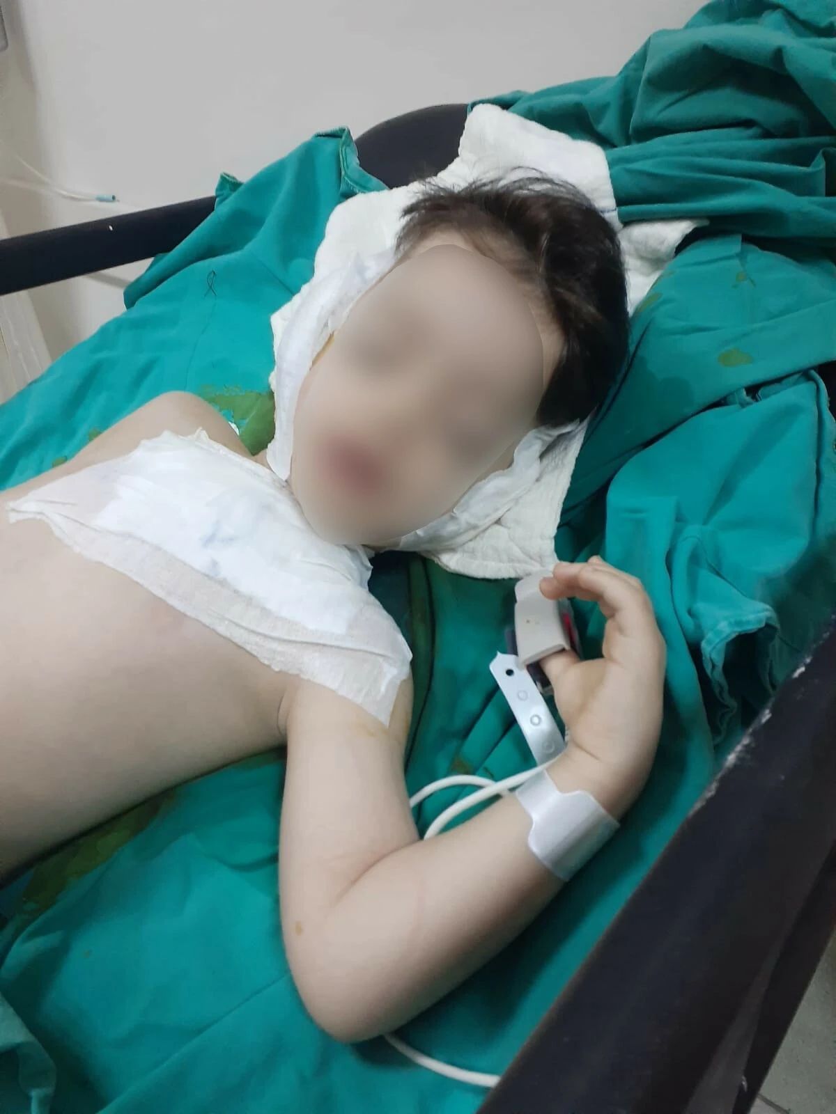 4 yaşındaki çocuğu 7 kere ameliyat edip kulağını çürüttüler! - 2. Resim