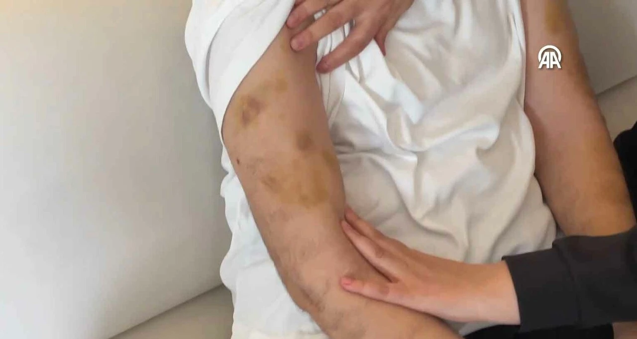 Otizmli öğrencisini sopayla dövüp, boğazını sıkan öğretmen tutuklandı - 1. Resim