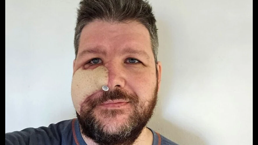 Kendini ve oğlunu ısıran ayıyı yiyerek intikam aldı - 4. Resim