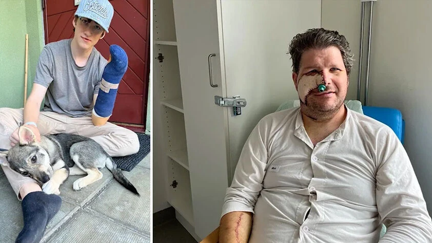 Kendini ve oğlunu ısıran ayıyı yiyerek intikam aldı - 1. Resim