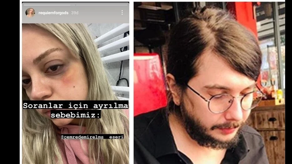 Fenomen Cemre Demirel’in sevgilisinden şiddet iddiası