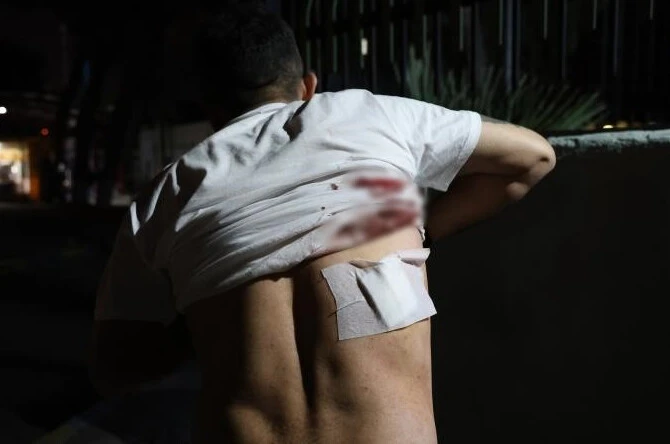 Taksiciye dehşeti yaşattı! Şoförün sırtına makas sapladı! - 1. Resim