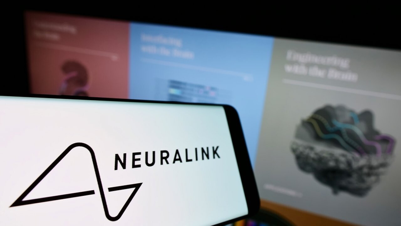 Elon Musk açıkladı: Neuralink beyin çipi takılan hastanın son durumu