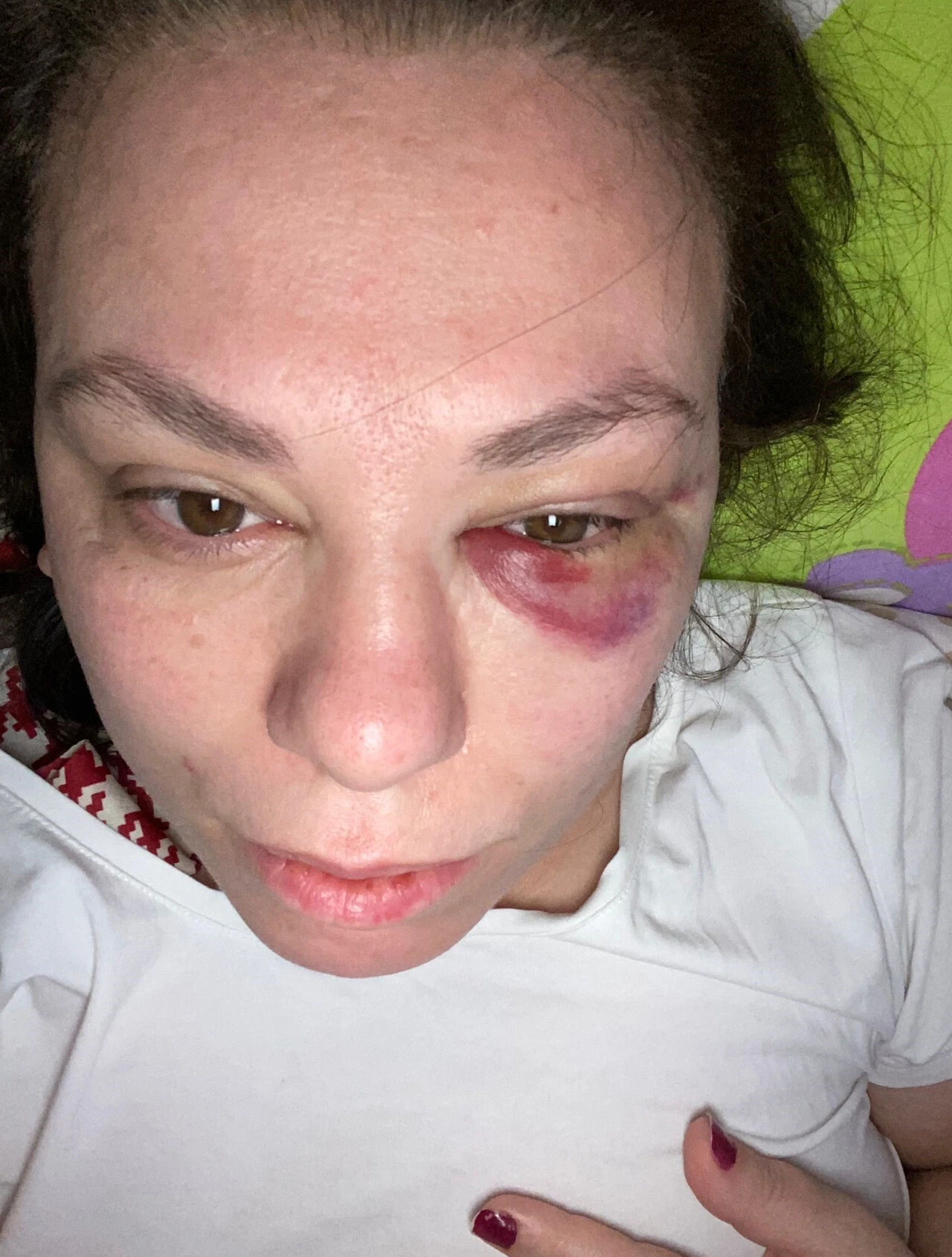 Otobüste "Çocuğunu kucağına al" kavgasında kadına yumruk! - 1. Resim