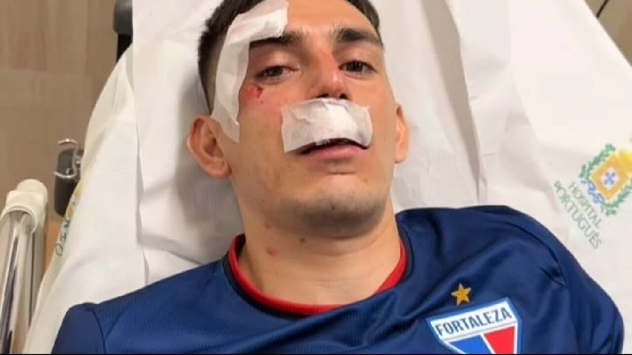 Takım otobüsüne bombalı saldırı! 6 futbolcu yaralandı