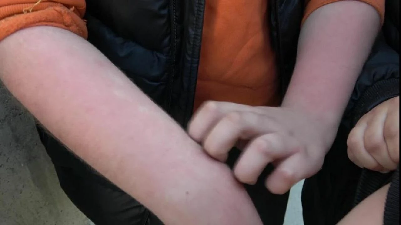 Pamuk şekerleri yiyen ortaokul öğrencileri hastaneye kaldırıldı - 2. Resim