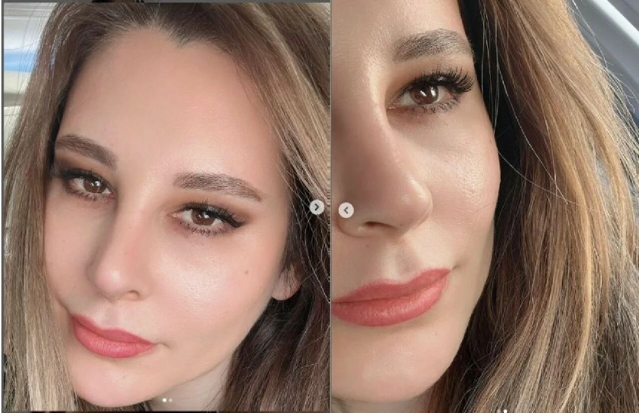 Funda Arar estetik furyasına katıldı! Son paylaşımıyla Merve Özbey'e benzetildi - 1. Resim