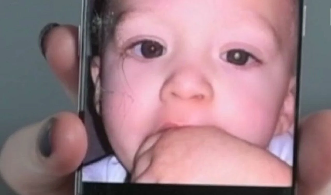 Telefonuyla bir fotoğraf çekti ve bebeğinin nadir göz hastalığını fark etti! - 1. Resim