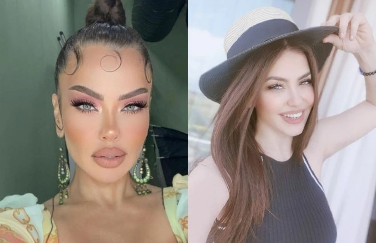 Şarkıcı Lara geçirdiği estetiklerle Angelina Jolie’ye benzetildi