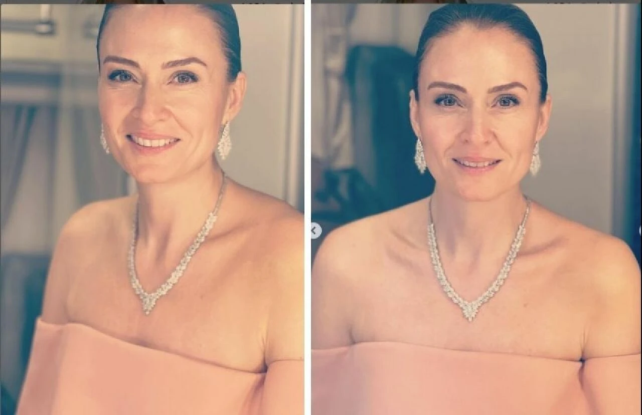 Sakla Beni dizisinin Filiz’i Ceyda Düvenci iğne ipliğe döndü! Son fotoğrafına beğeni yağdı - 1. Resim