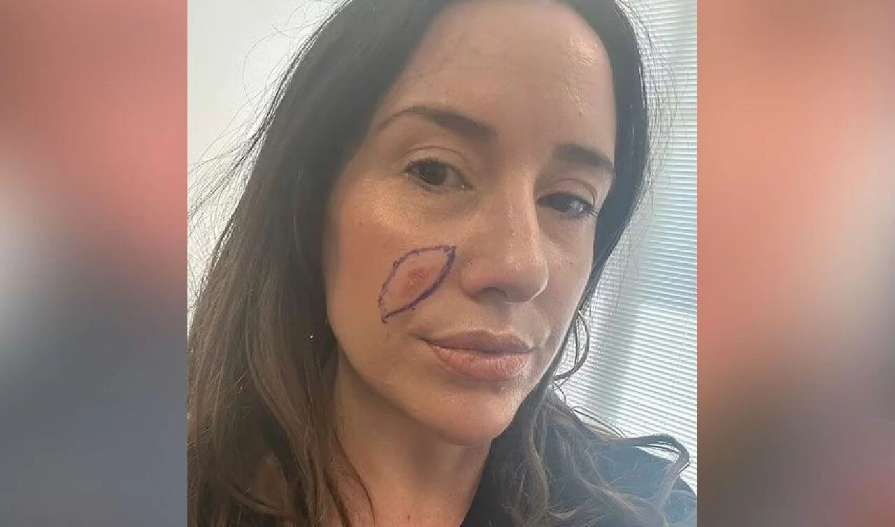 Güneş lekesi sandı az kalsın hayatından oluyordu! Genç anne şimdi herkesi uyarıyor