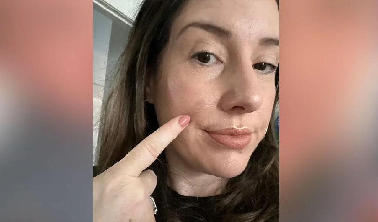 Güneş lekesi sandı az kalsın hayatından oluyordu! Genç anne şimdi herkesi uyarıyor