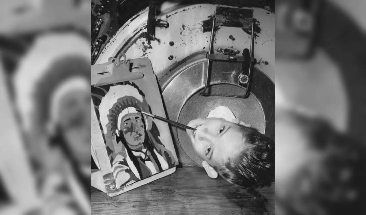 'Demir akciğer adam' 78 yaşında öldü: 72 yılını metal kapsülde geçirdi - 2. Resim