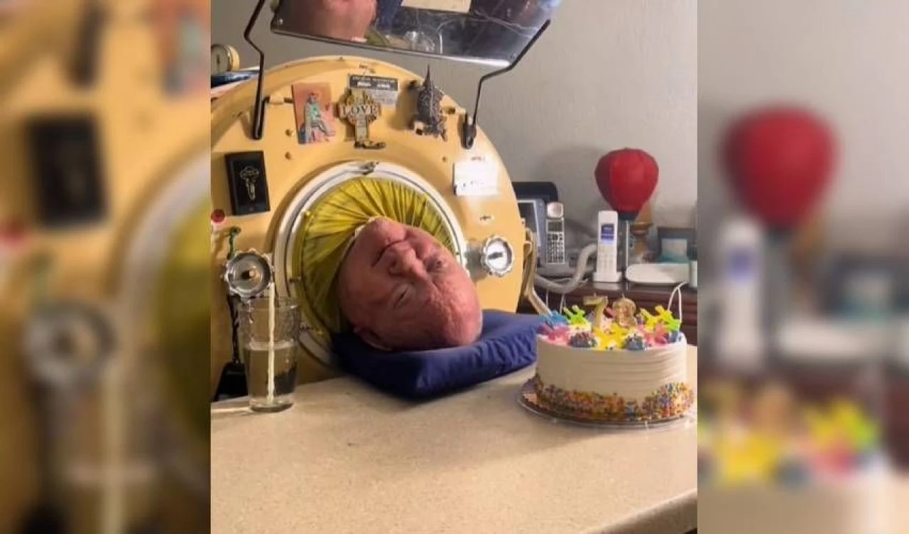 'Demir akciğer adam' 78 yaşında öldü: 72 yılını metal kapsülde geçirdi - 1. Resim