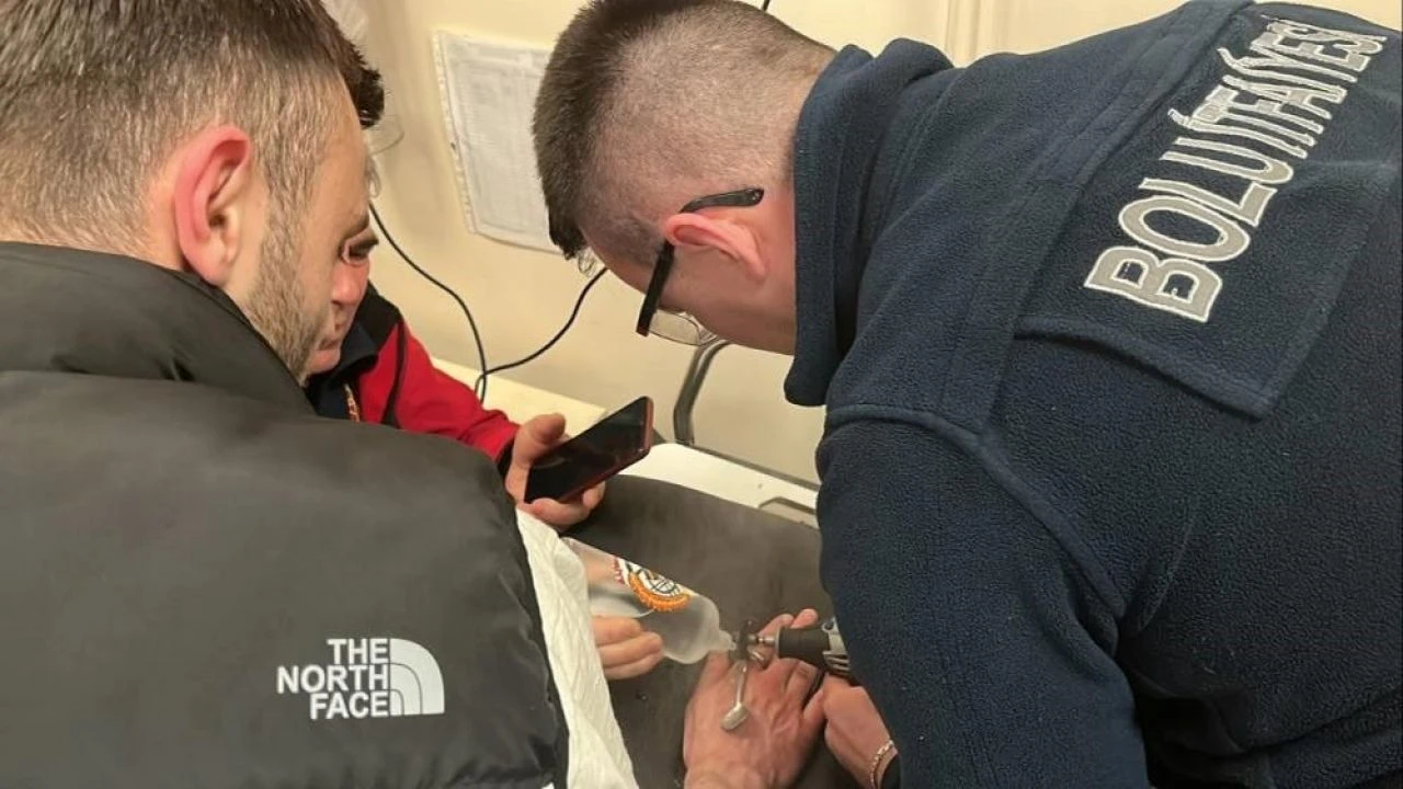 Yüzüğü parmağına sıkıştıran vatandaşın imdadına itfaiye yetişti - 2. Resim