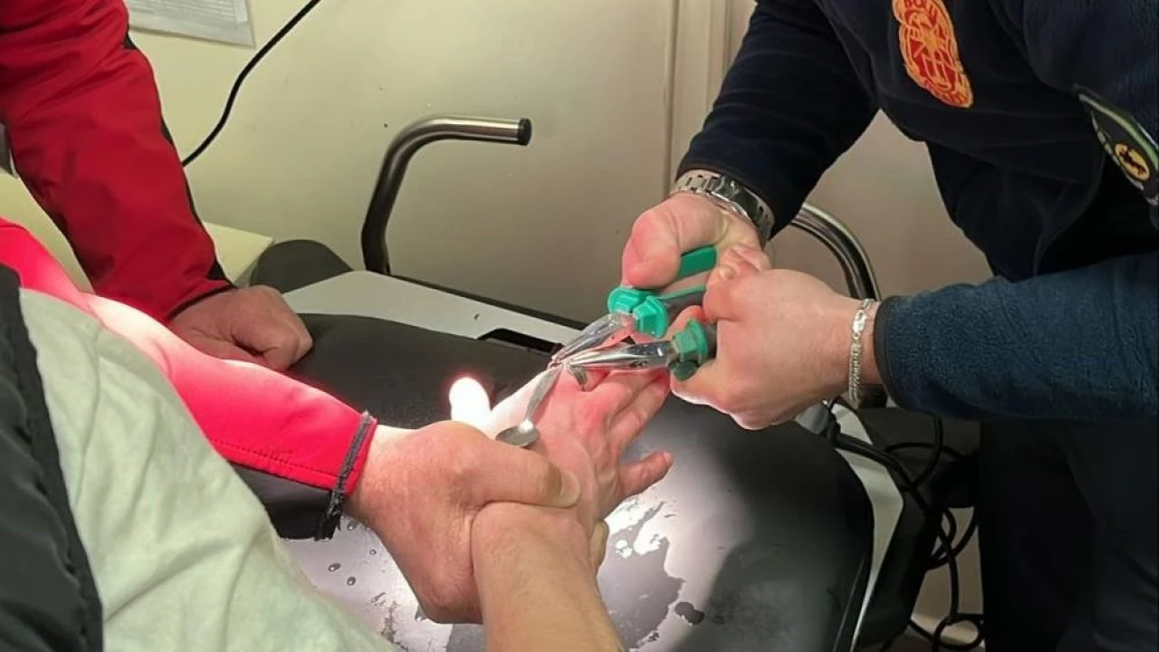 Yüzüğü parmağına sıkıştıran vatandaşın imdadına itfaiye yetişti - 3. Resim