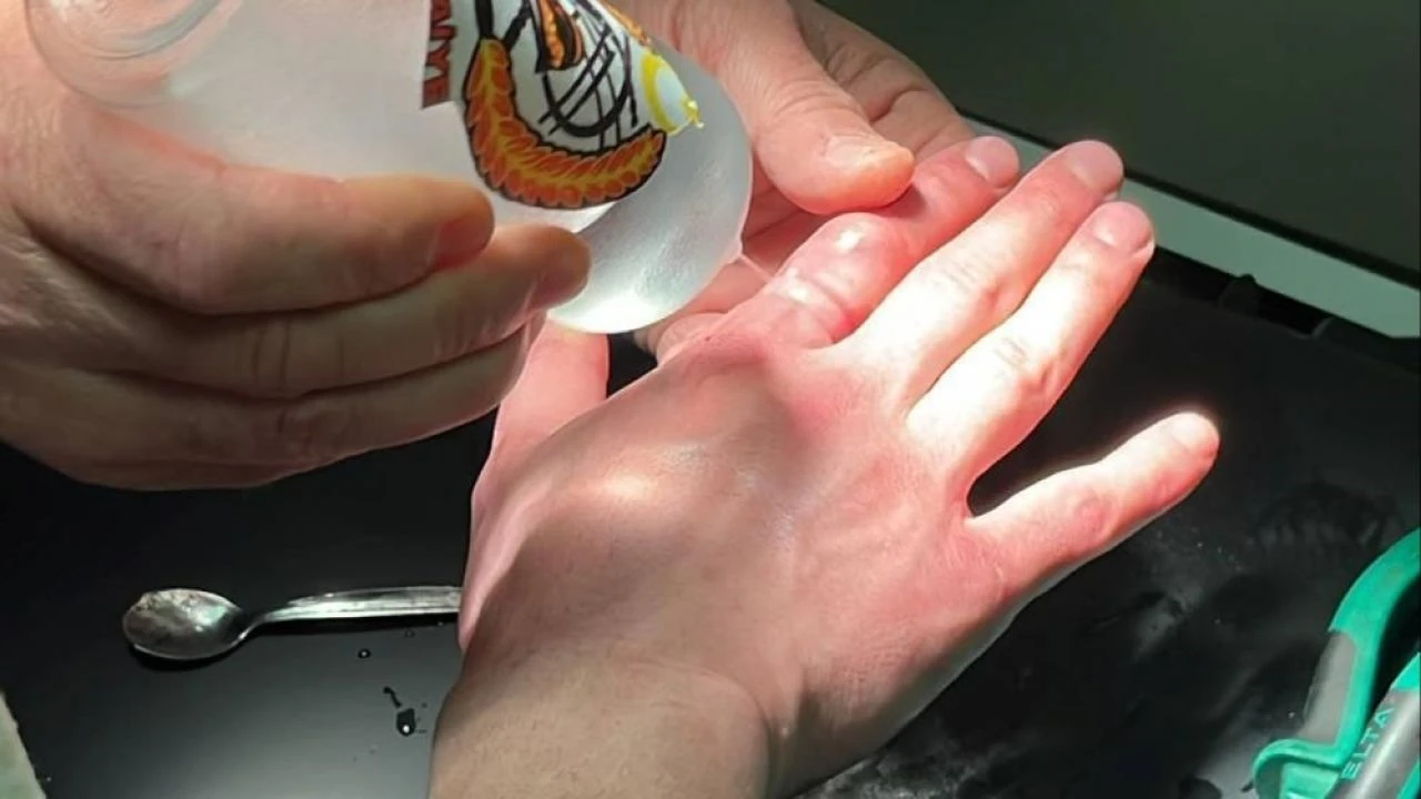 Yüzüğü parmağına sıkıştıran vatandaşın imdadına itfaiye yetişti - 4. Resim