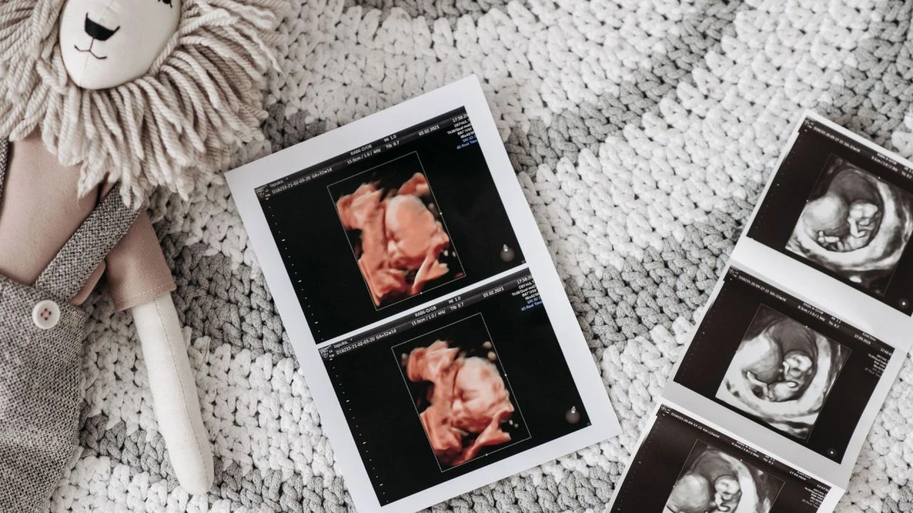 Gebelere uzmanlarından Ramazan ayı açıklaması! Hamilelerin oruç tutması günah mı?