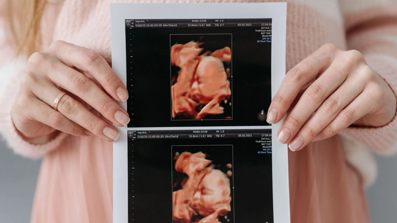 Gebelere uzmanlarından Ramazan ayı açıklaması! Hamilelerin oruç tutması günah mı?