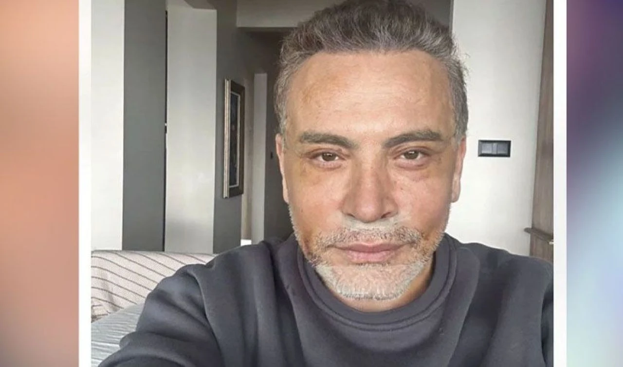 Cenk Eren'in estetikli hali şoke etti: Ne yaptınız? İsminizi de değiştirin tam olsun!