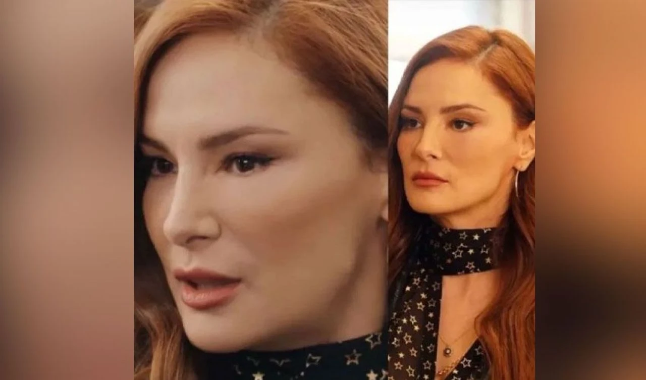 Yalı Çapkını dizisinin yıldızı Mine Tugay'ı ünlü estetikçi yaktı!