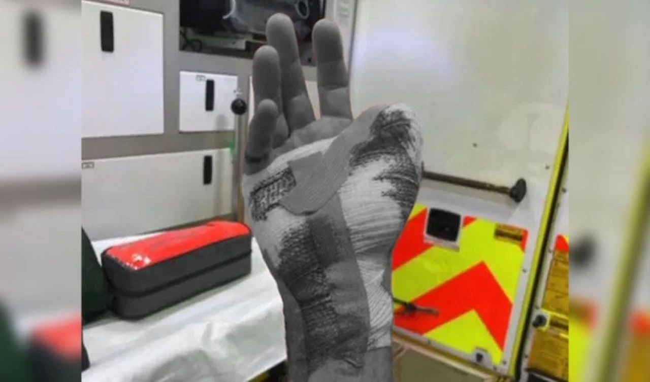 Akılalmaz olay! Kapısına gelen kuryeyi ısırarak sakat bıraktı - 2. Resim