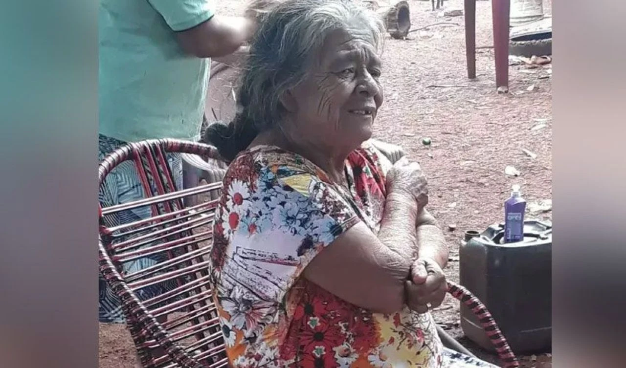 Mide ağrılarının sebebi bebek çıktı! Üstelik 56 yıldır karnındaydı - 1. Resim